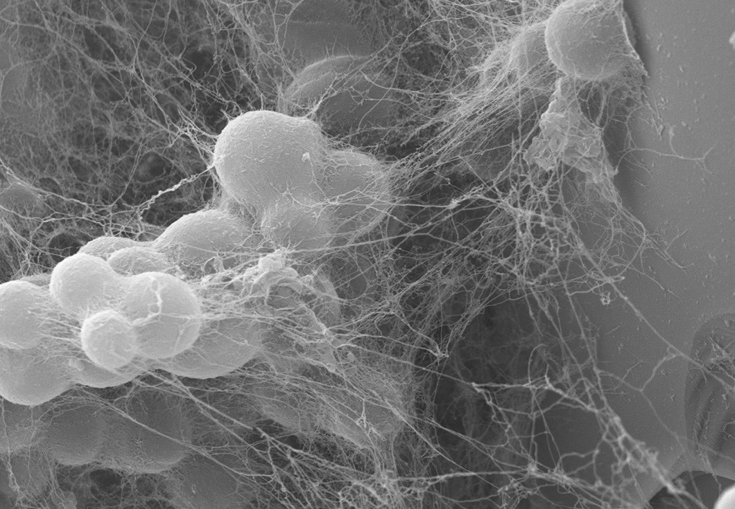 Paper des Monats 12/2022: TF Umwelt Biogene Verwitterungs-Mikroumgebung auf der Mineraloberfläche: Knufia petricola und seine polymere Matrix (hier Carotinoidmutante Δphd1 auf Olivin).