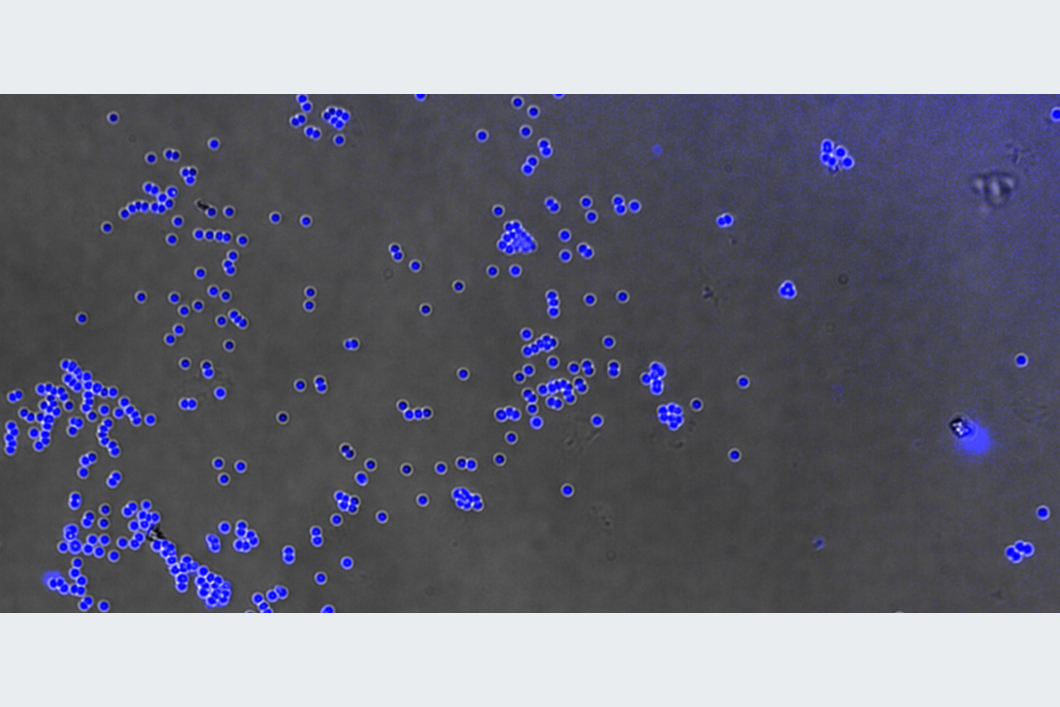 Paper of the month 03/2024: Environment The LPS-functionalization of polystyrene microparticles can be made visible via the specific interactions of LPS with a fluorescence marker.