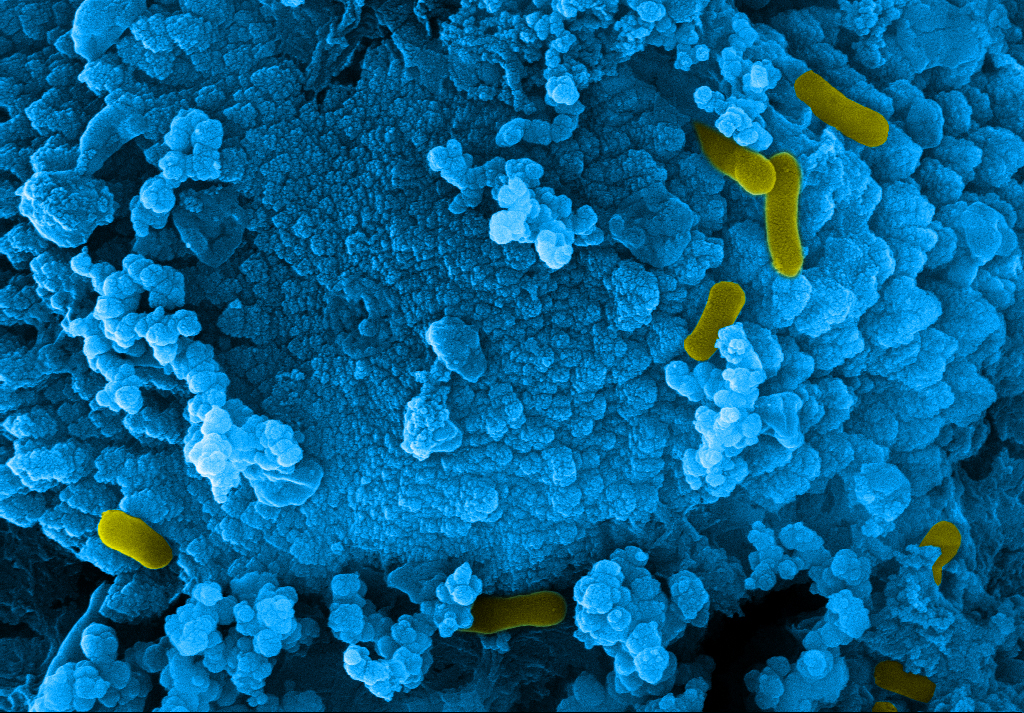 Microbiologically influenced corrosion affects all materials. BAM's research is interdisciplinary and embedded in a global network.