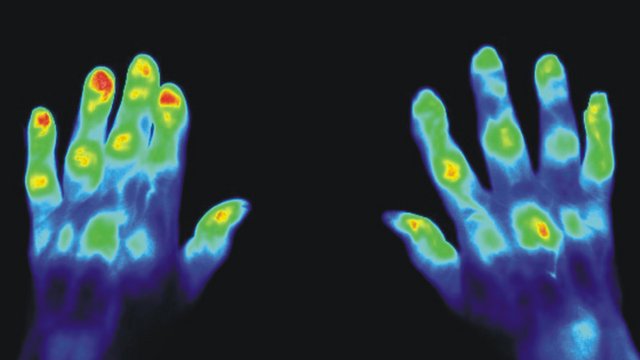 A medical picture of two hands with the aid of photoluminescent substances.  Tile preview