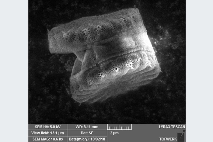 Automatisierte Einzelalgenanalytik von Cyclotella meneghinianamittels ICP-MS