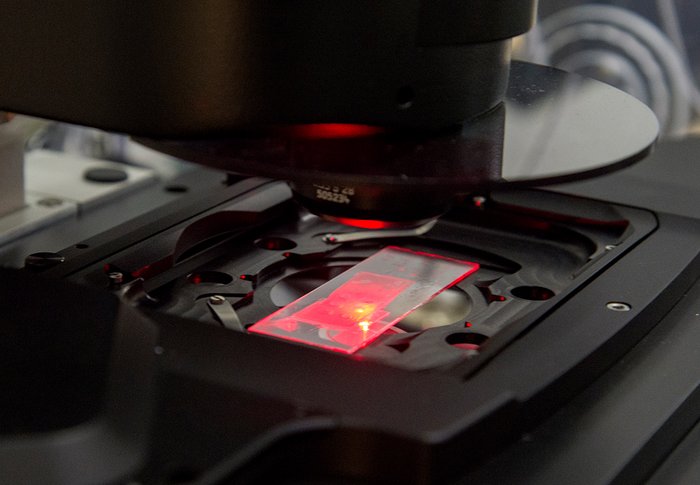 Visualization of the biofilm pH with a microscope