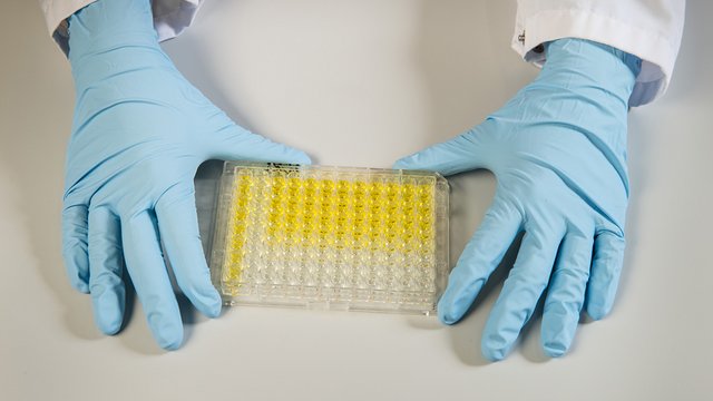 Der Vorteil der Immunoassays liegt darin, dass man deutlich weniger Ger&auml;t als bei bisherigen aufwendigen Verfahren ben&ouml;tigt. Kachel Vorschau