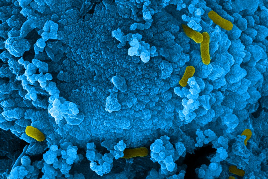 Topic: Environment &ndash; Microbial corrosion