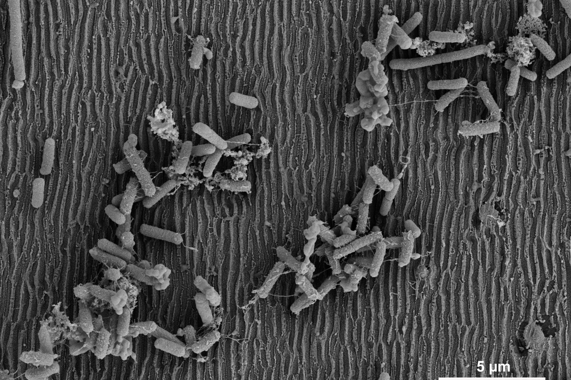 Laser-Textured Surfaces: A Way to Control Biofilm Formation?