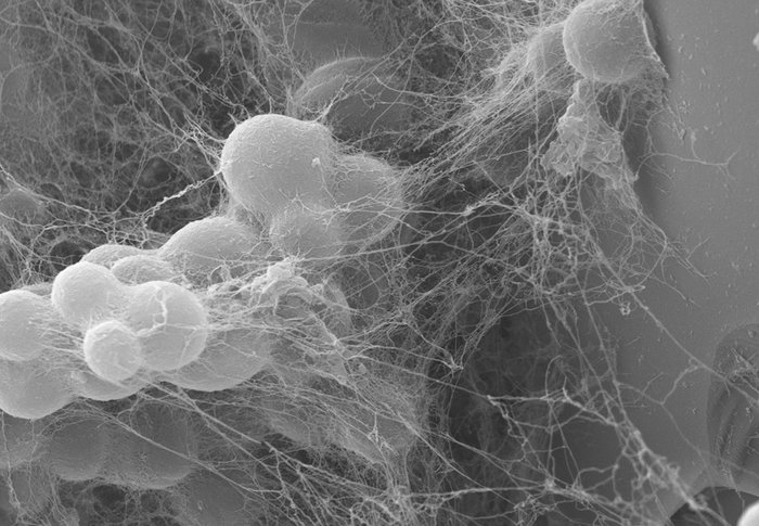 Biogene Verwitterungs-Mikroumgebung auf der Mineraloberfläche: Knufia petricola und seine polymere Matrix (hier Carotinoidmutante Δphd1 auf Olivin).