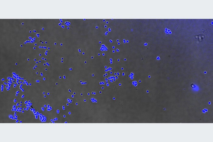 Über spezifische Wechselwirkungen mit einem Fluoreszenzmarker kann die LPS-Funktionalisierung der Polystyrol-Mikropartikel sichtbar gemacht werden.
